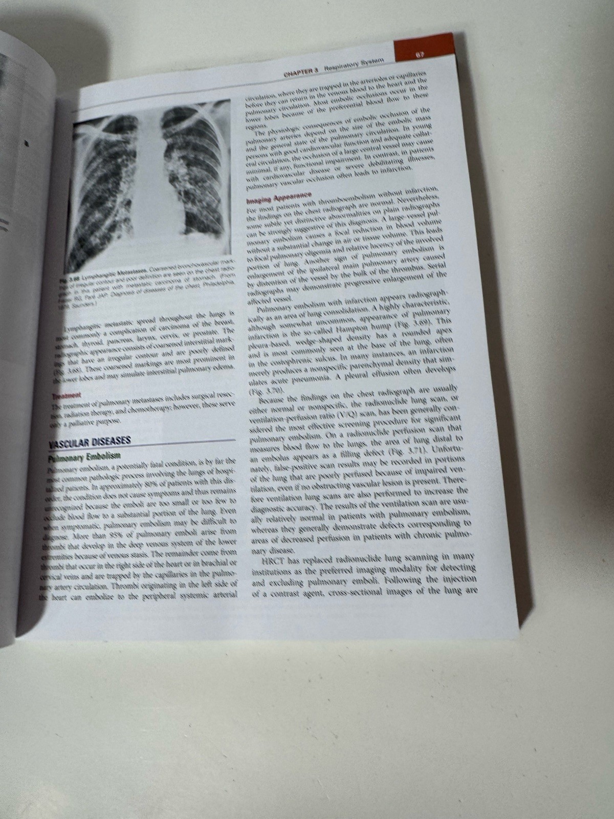 Comprehensive Radiographic Pathology Seventh Edition Eisenberg Johnson PB