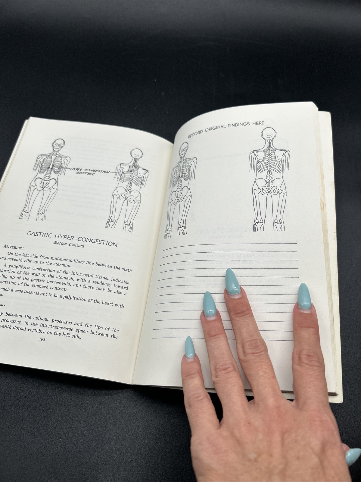 Chapman, Frank: AN ENDOCRINE INTERPRETATION OF CHAPMAN’S REFLEXES 1969 SC Book