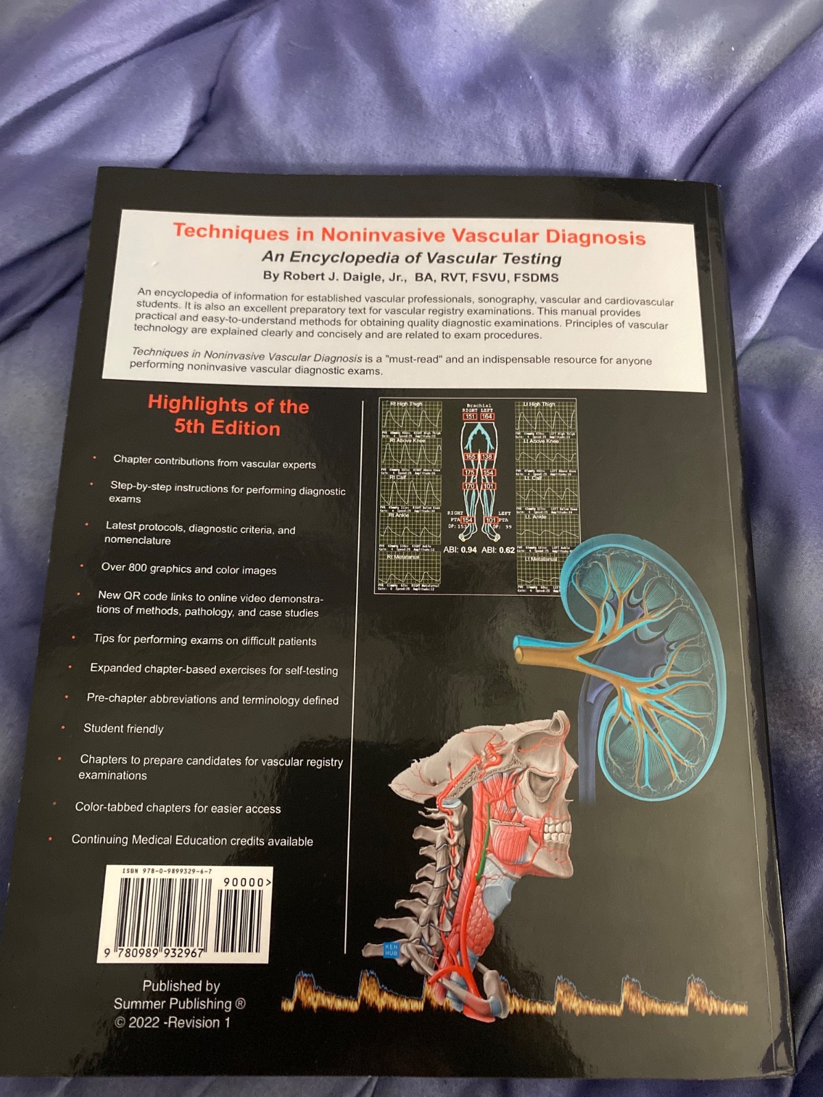 Technique in noninvasive vascular diagnosis an encyclopedia of vascular testing
