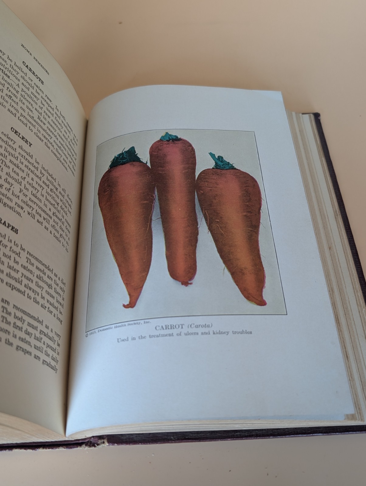 Health Knowledge 2 Vol Set 1927 Medical Anatomy Flap Illustrations Corish