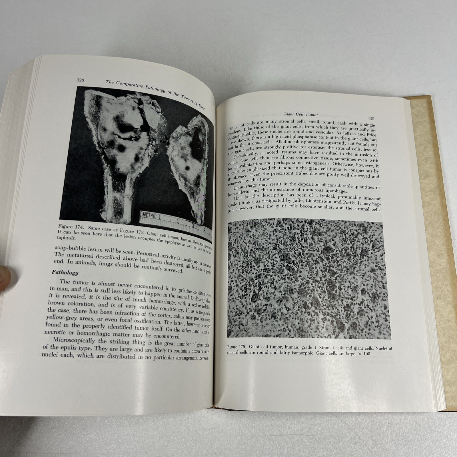 Comparative Pathology of the Tumors of Bone by Jacobson 1971 CSI Vintage Medical