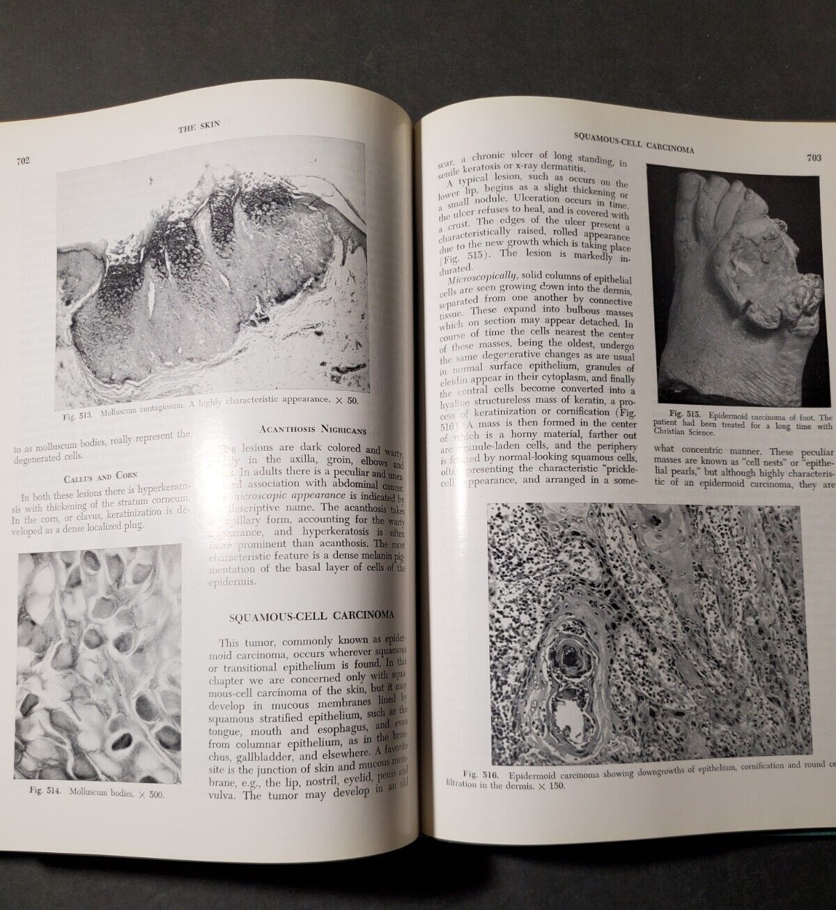 BOYD’S PATHOLOGY FOR THE SURGEON 8th Ed.by William Anderson 1967 HC Saunders