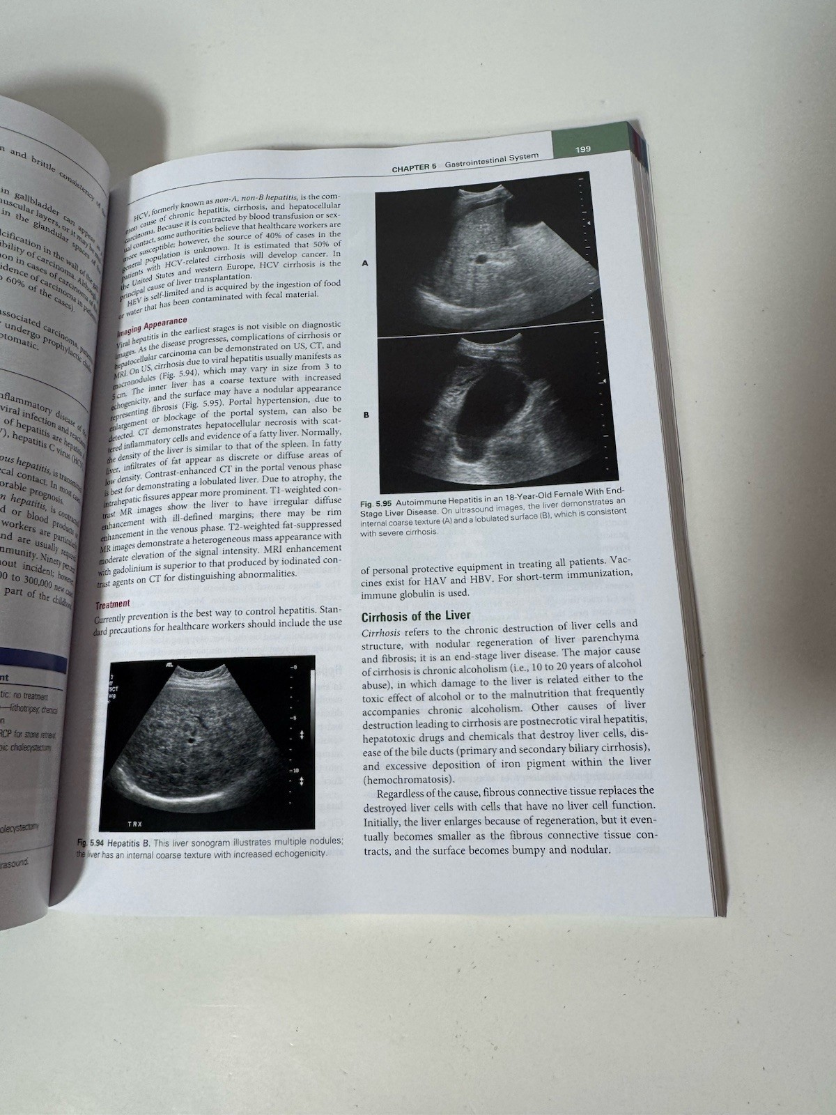 Comprehensive Radiographic Pathology Seventh Edition Eisenberg Johnson PB