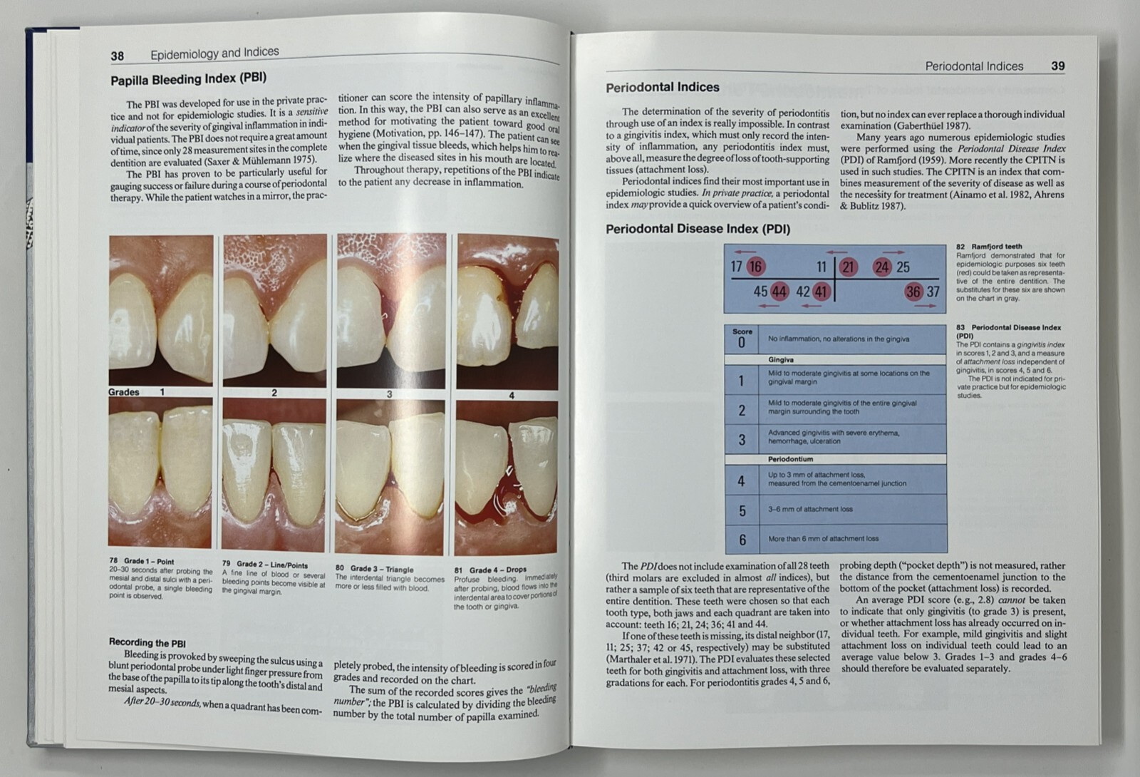 Color Atlas of Dental Medicine: Periodontology by Rateitschak, Wolf & Hassell HC