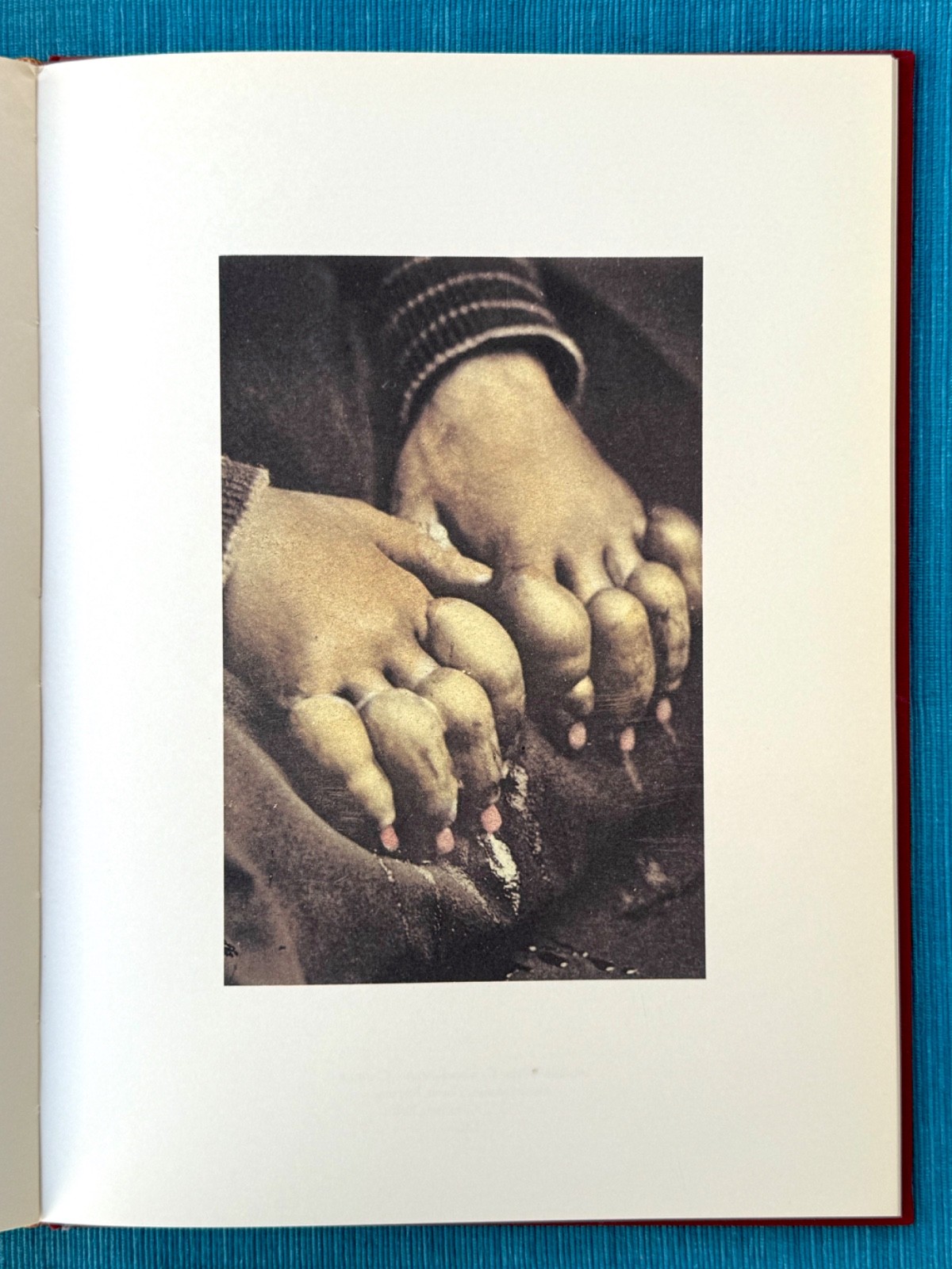 MASTERPIECES OF MEDICAL PHOTOGRAPHY / Stanley B. Burns, M.D. – 1987 1st HC/DJ