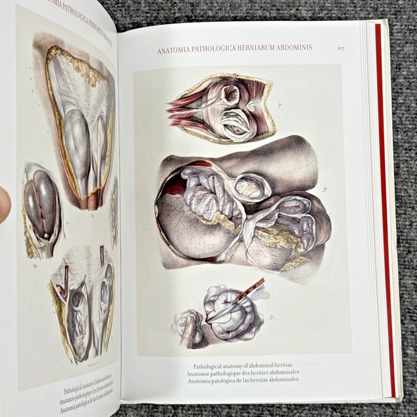 Atlas of Human Anatomy and Surgery The Complete Plates, Bourgery, Jacob, Taschen