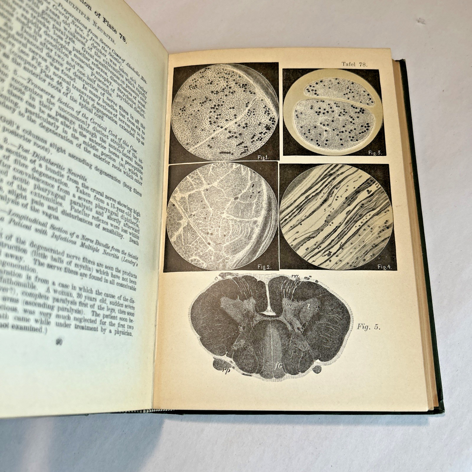 Atlas of Normal and Pathological Nervous Systems ~ 1896 ~ C. Jakob ~ Color Illus
