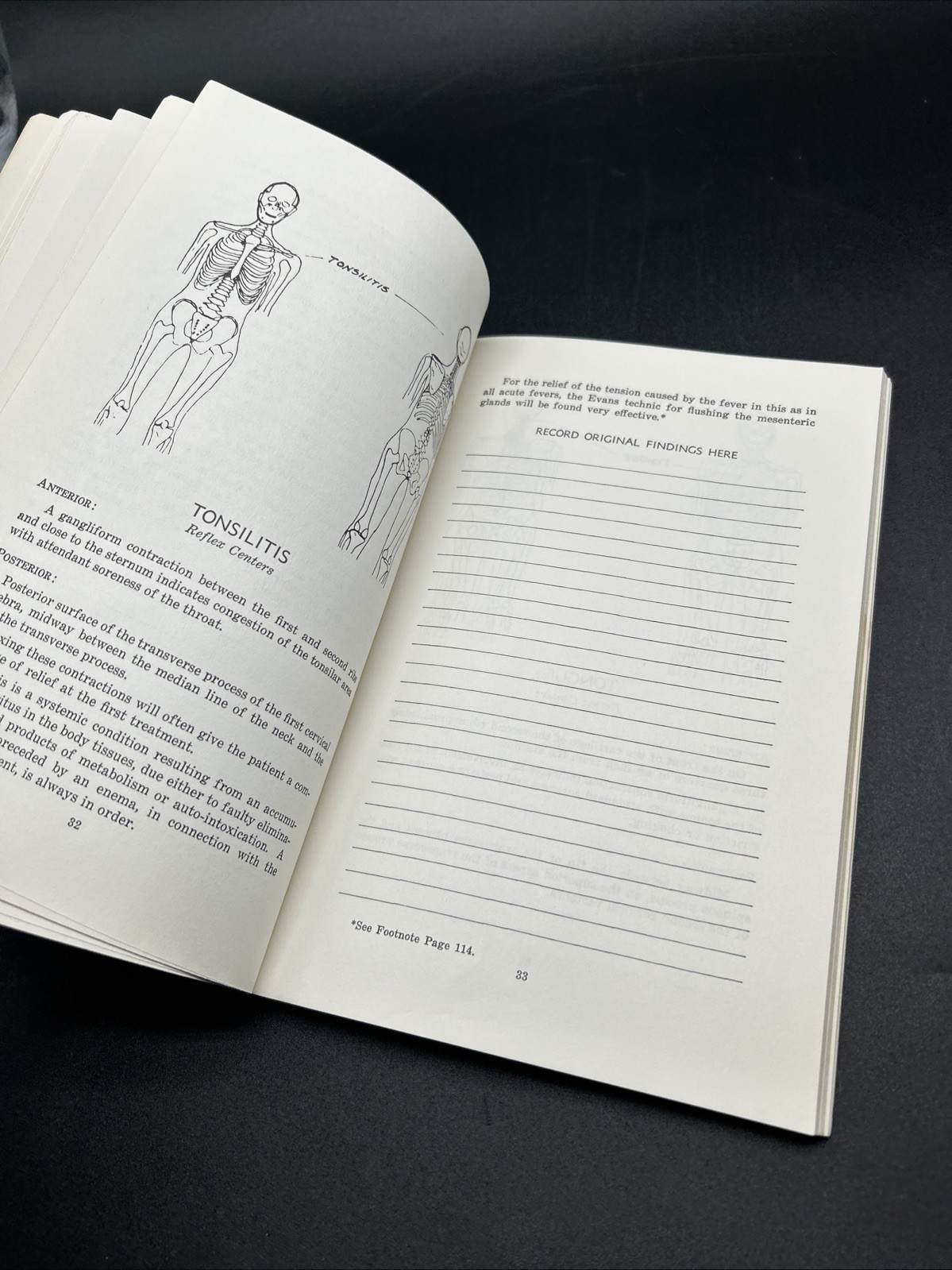 Chapman, Frank: AN ENDOCRINE INTERPRETATION OF CHAPMAN’S REFLEXES 1969 SC Book