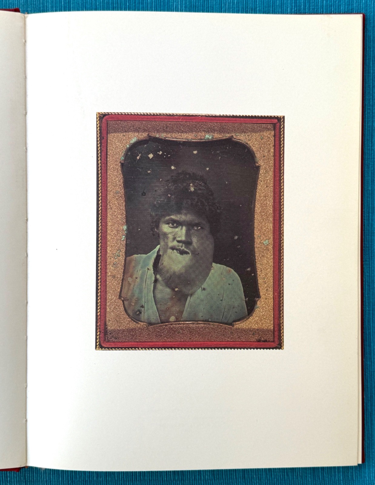 MASTERPIECES OF MEDICAL PHOTOGRAPHY / Stanley B. Burns, M.D. – 1987 1st HC/DJ