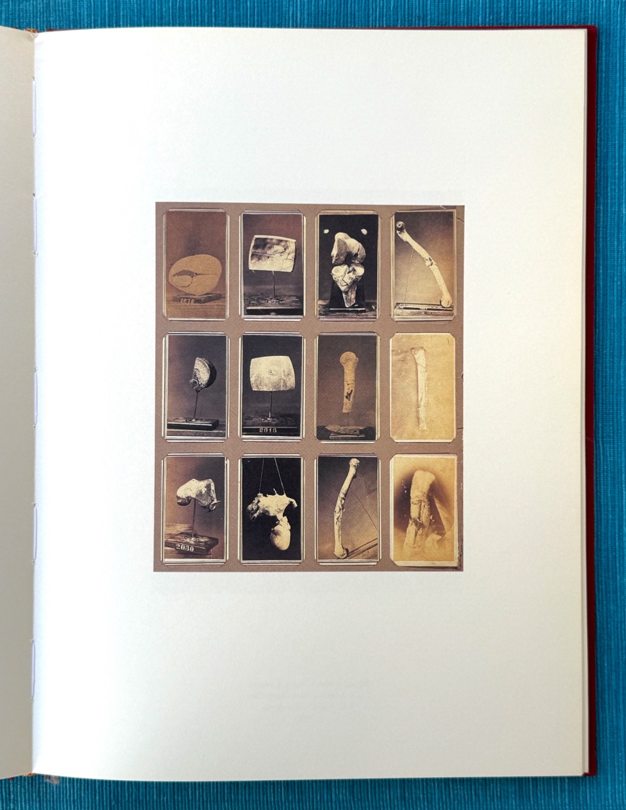 MASTERPIECES OF MEDICAL PHOTOGRAPHY / Stanley B. Burns, M.D. – 1987 1st HC/DJ