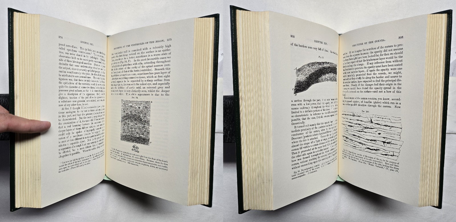 Cellular Pathology by Rudolph Virchow (The Classics of Medicine Library) 1978