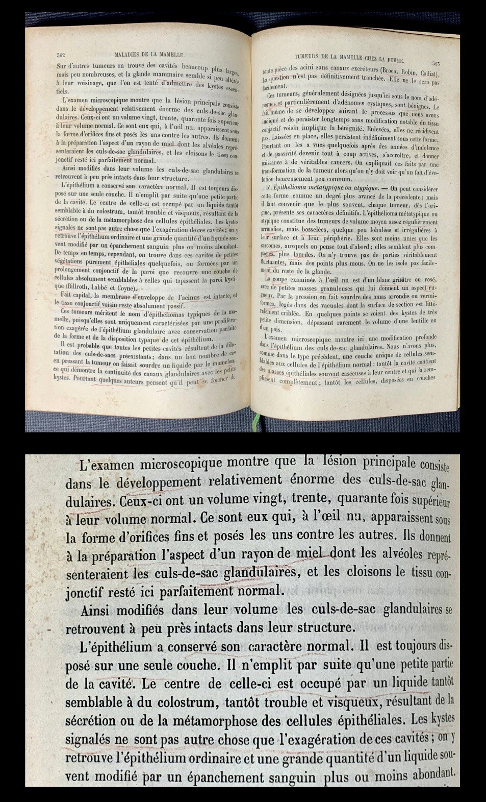 ANTIQUE 19th Century Medical French Book PATHOLOGY diseases DIAGNOSIS Medicine