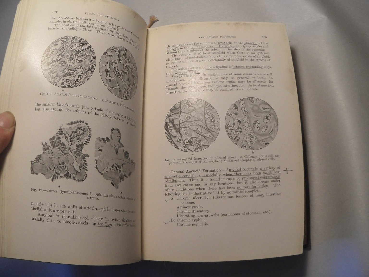 Principles of Pathologic Histology Mallory 1918 Medical Textbook Illustrated