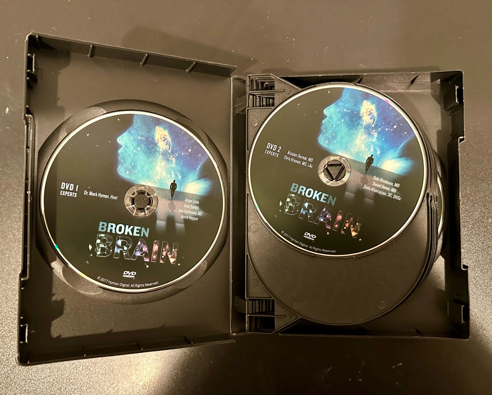 Dr. Mark Hyman – Broken Brain Expert Interviews DVD, Workbook, Transcripts, Etc
