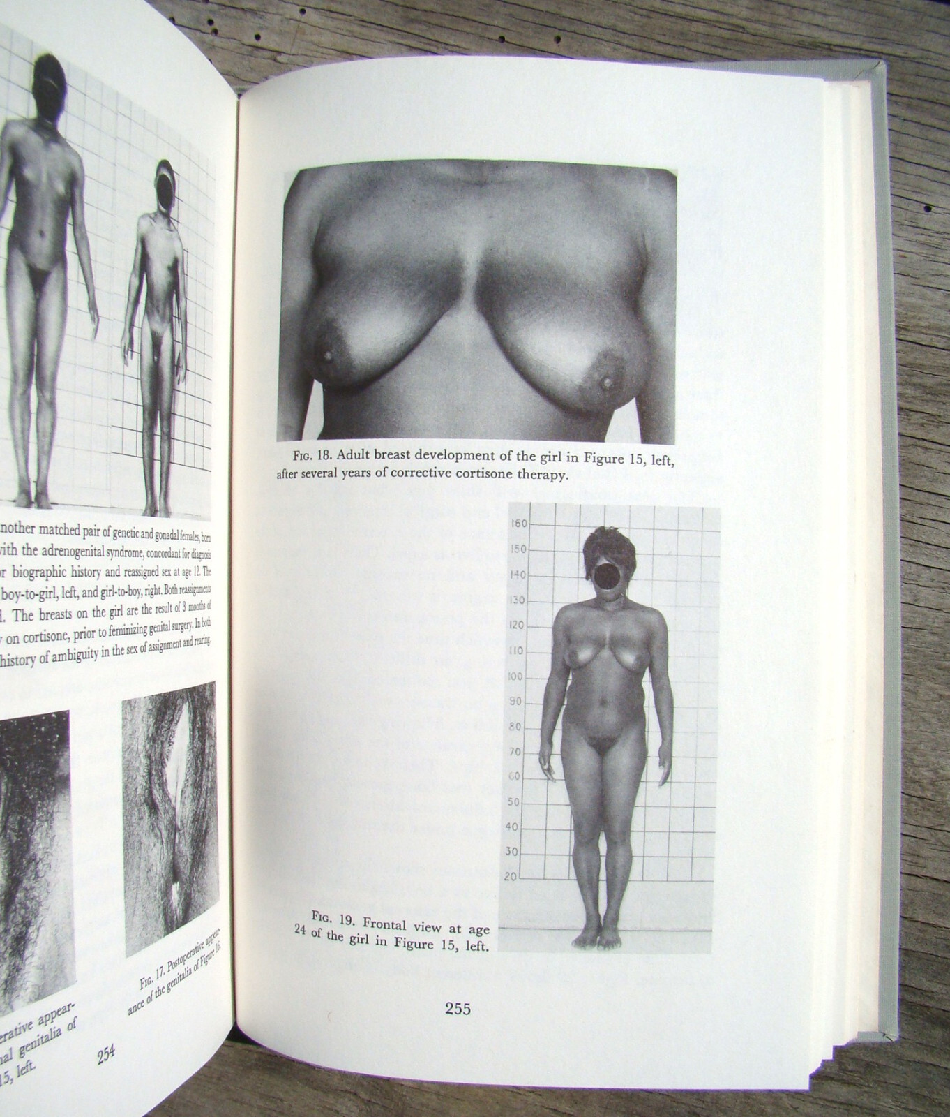 Nebraska Symposium On Motivation ~23 Vols 1953-75~ Animal Experiments Sex Gender