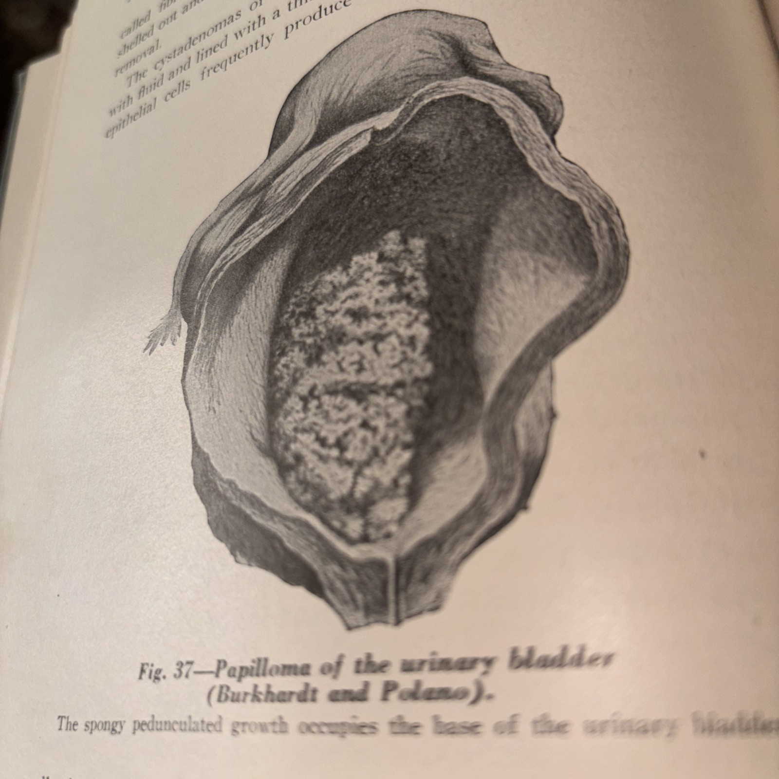 Text Book of pathology 1945, 5th Edition, Illustrated