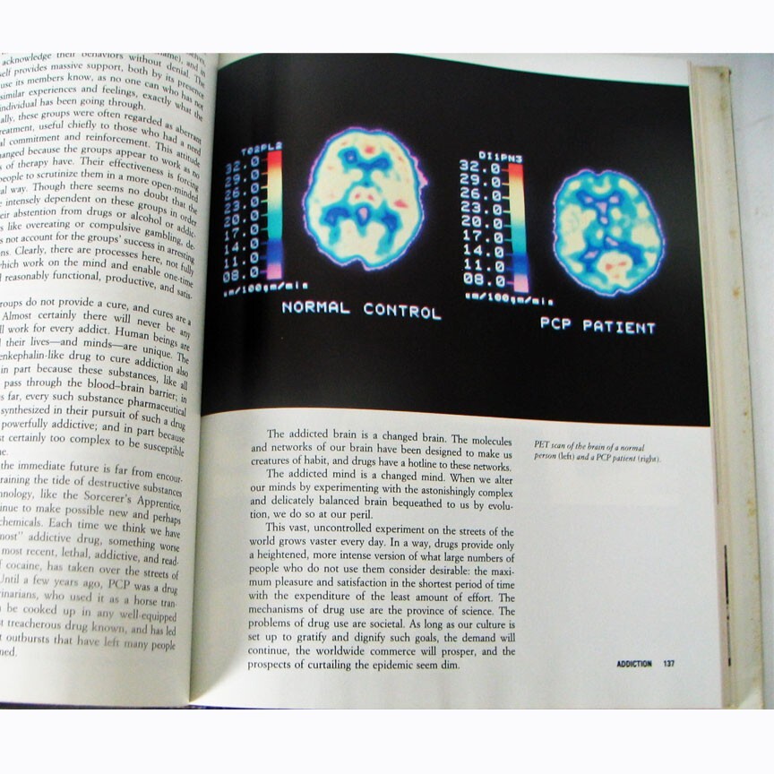 The Mind, Richrd M. Restak MD, Hardcover with Dust Jacket, 328 pages Mint