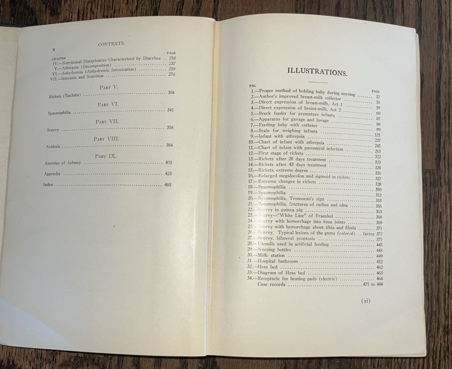 Principles And Practice Of Infant Feeding 1922 Julius H. Hess M.D. Hardback