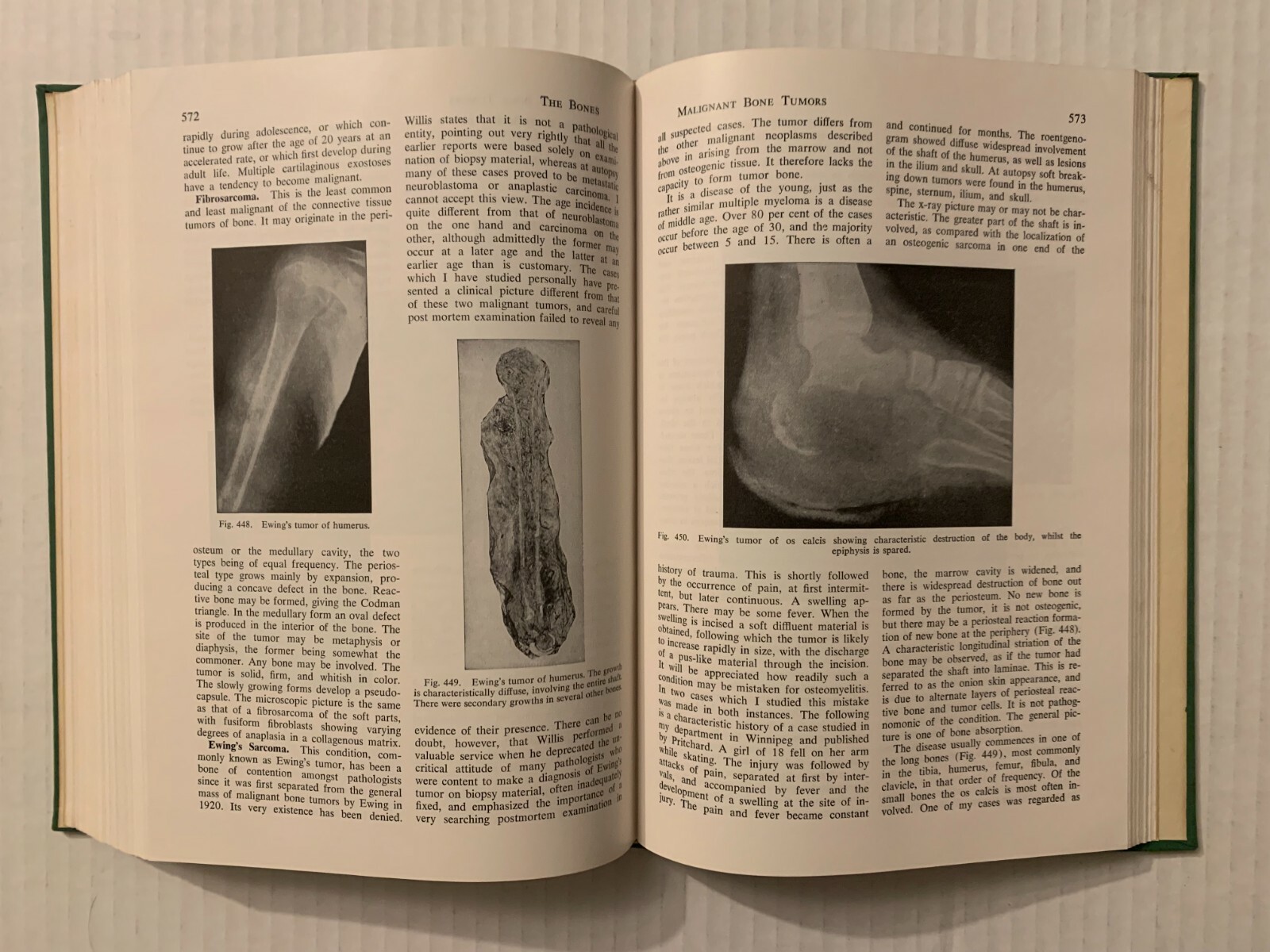 Vtg 1955 Hardcover Pathology for the Surgeon William Boyd 7th Edition Saunders