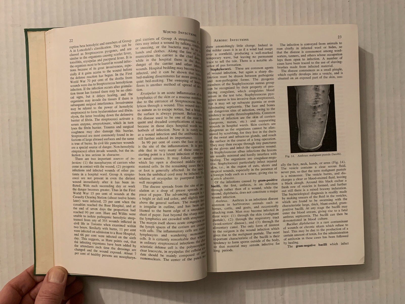Vtg 1955 Hardcover Pathology for the Surgeon William Boyd 7th Edition Saunders