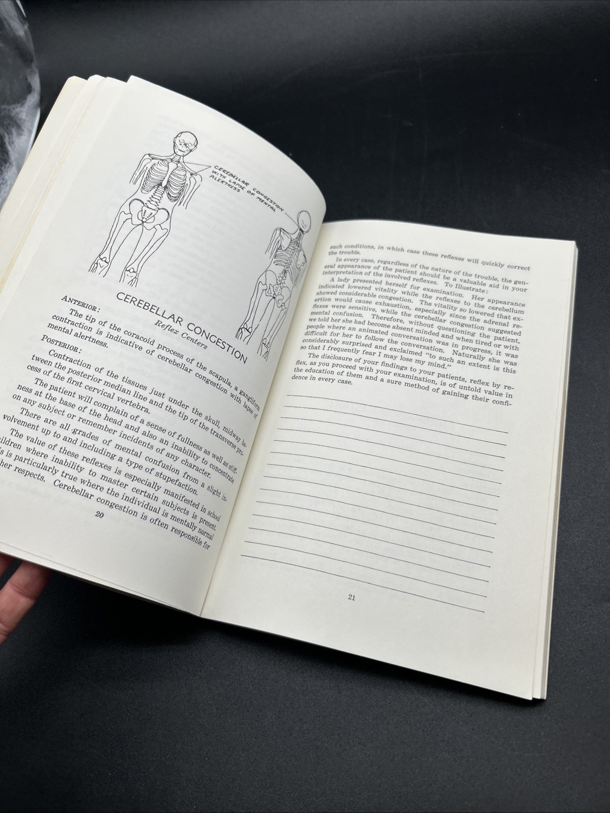 Chapman, Frank: AN ENDOCRINE INTERPRETATION OF CHAPMAN’S REFLEXES 1969 SC Book
