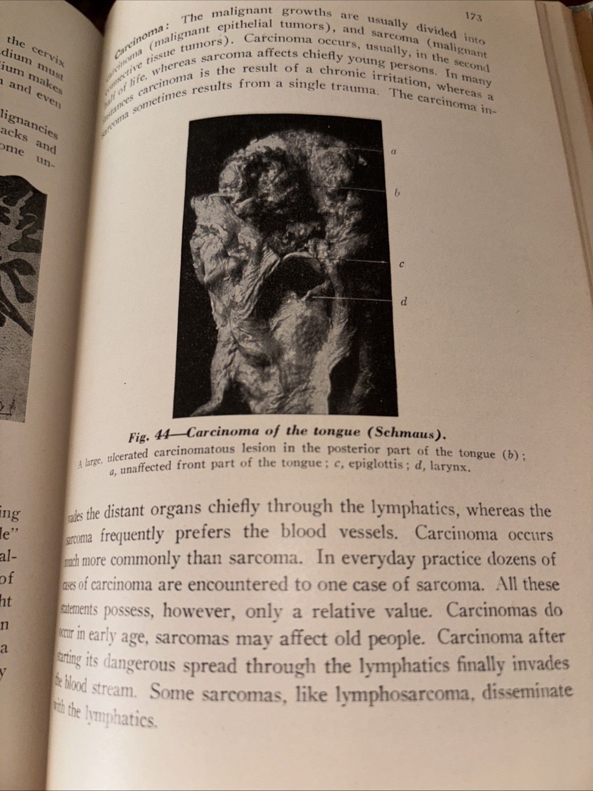 Text Book of pathology 1945, 5th Edition, Illustrated