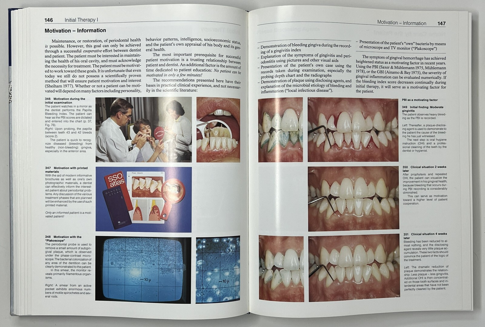 Color Atlas of Dental Medicine: Periodontology by Rateitschak, Wolf & Hassell HC
