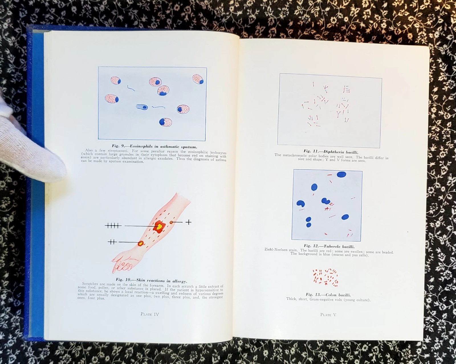 Microbiology Pathology And Nursing Eugene C. Piette, 1940, HC