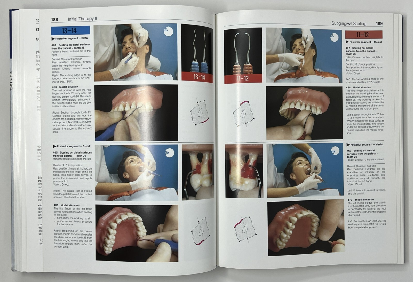 Color Atlas of Dental Medicine: Periodontology by Rateitschak, Wolf & Hassell HC