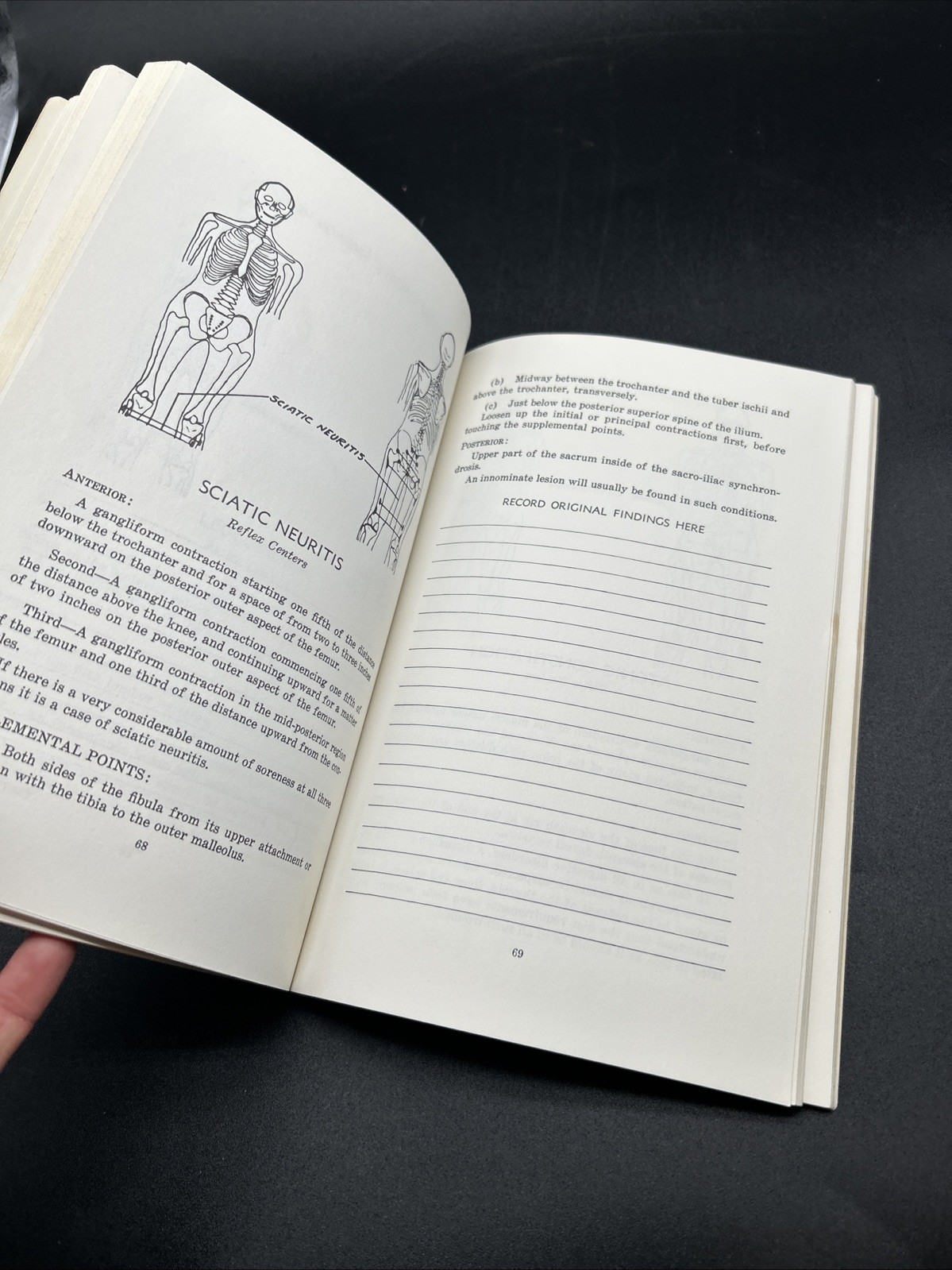 Chapman, Frank: AN ENDOCRINE INTERPRETATION OF CHAPMAN’S REFLEXES 1969 SC Book