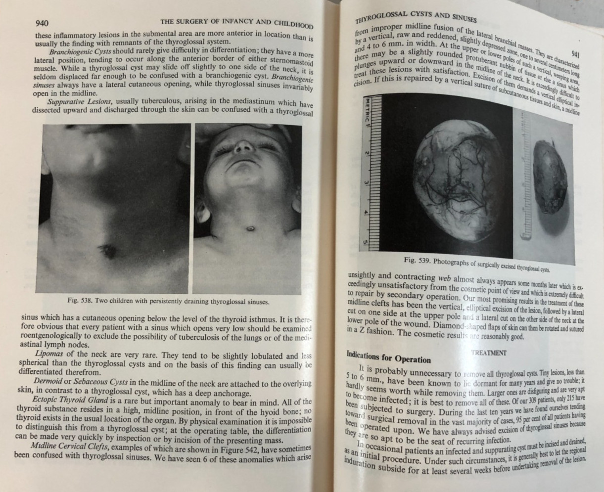 The Surgery of Infancy and Childhood, Gross, 1953, E-119