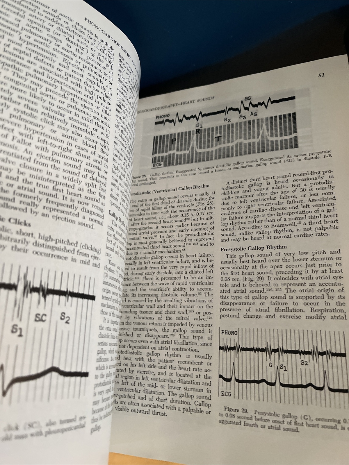 Diseases of the Heart by Friedberg, Charles K. 1966 HC Vol 1 & 2, Third Edition