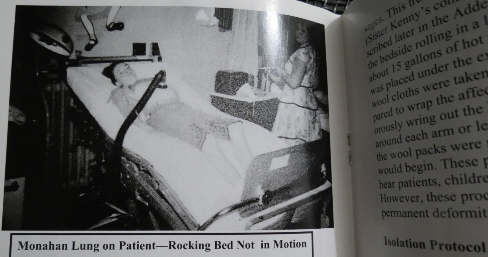 JODY’S EXPERIENCES IN POLIO NURSING 1952-1953 Pittsburgh ZOGRAN Iron Lung HEALTH