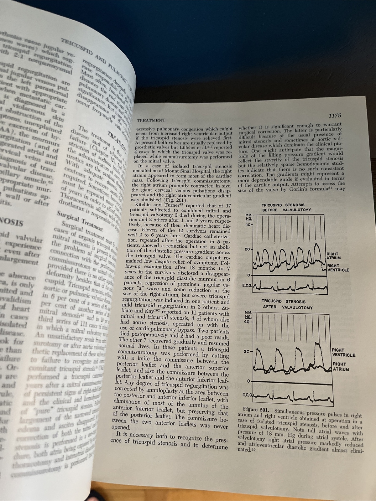 Diseases of the Heart by Friedberg, Charles K. 1966 HC Vol 1 & 2, Third Edition