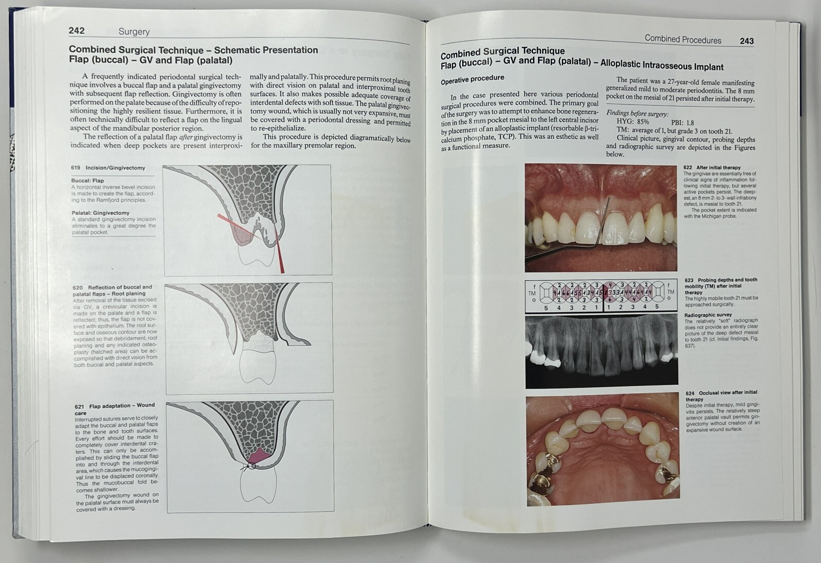 Color Atlas of Dental Medicine: Periodontology by Rateitschak, Wolf & Hassell HC