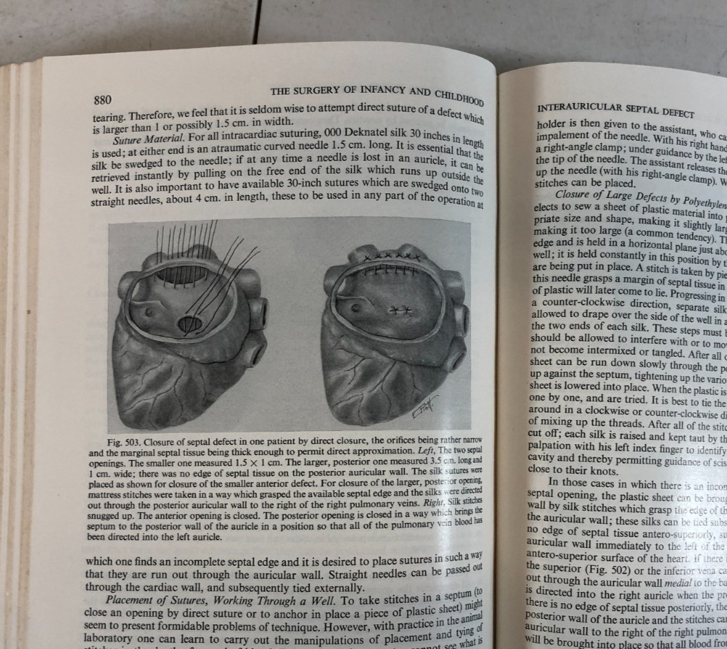The Surgery of Infancy and Childhood, Gross, 1953, E-119