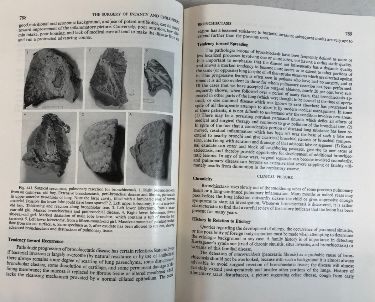 The Surgery of Infancy and Childhood, Gross, 1953, E-119