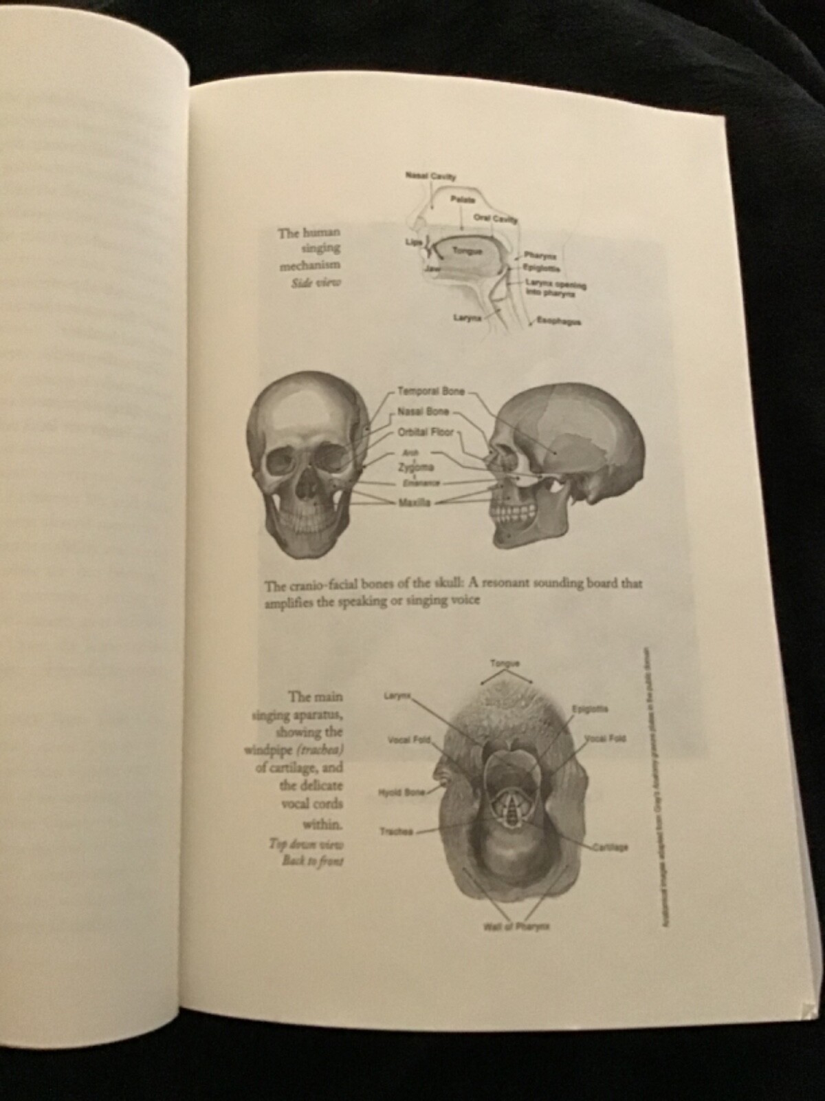 Rearranged:An Opera Singers Facial Cancer And Life Transposed-GOOD-USED-383pages