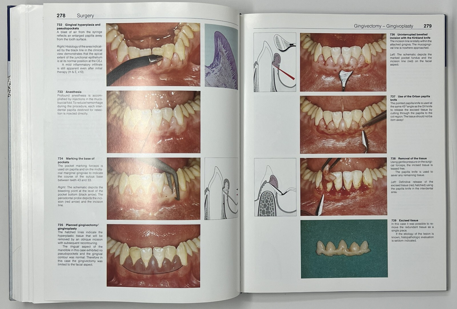 Color Atlas of Dental Medicine: Periodontology by Rateitschak, Wolf & Hassell HC