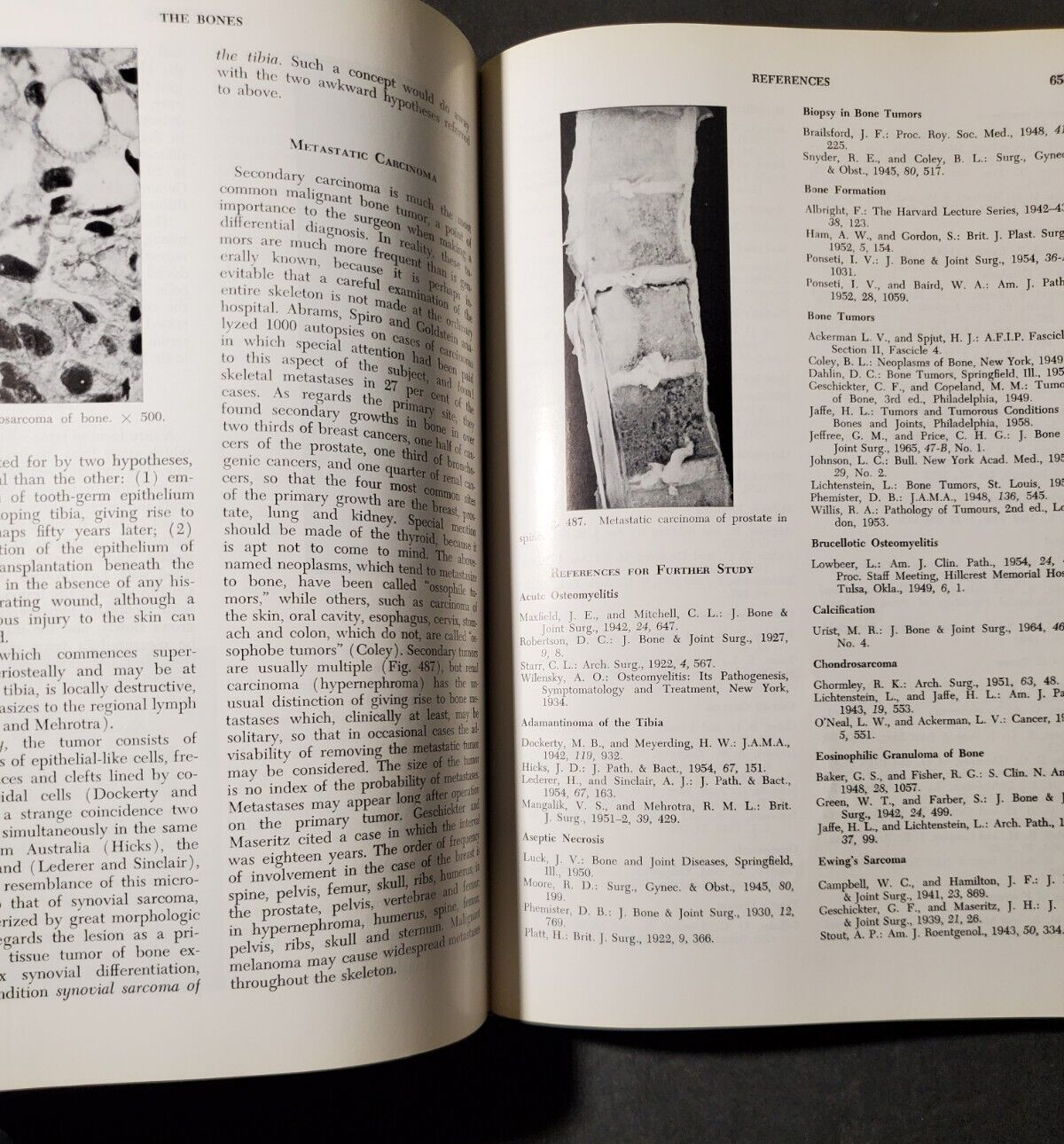 BOYD’S PATHOLOGY FOR THE SURGEON 8th Ed.by William Anderson 1967 HC Saunders