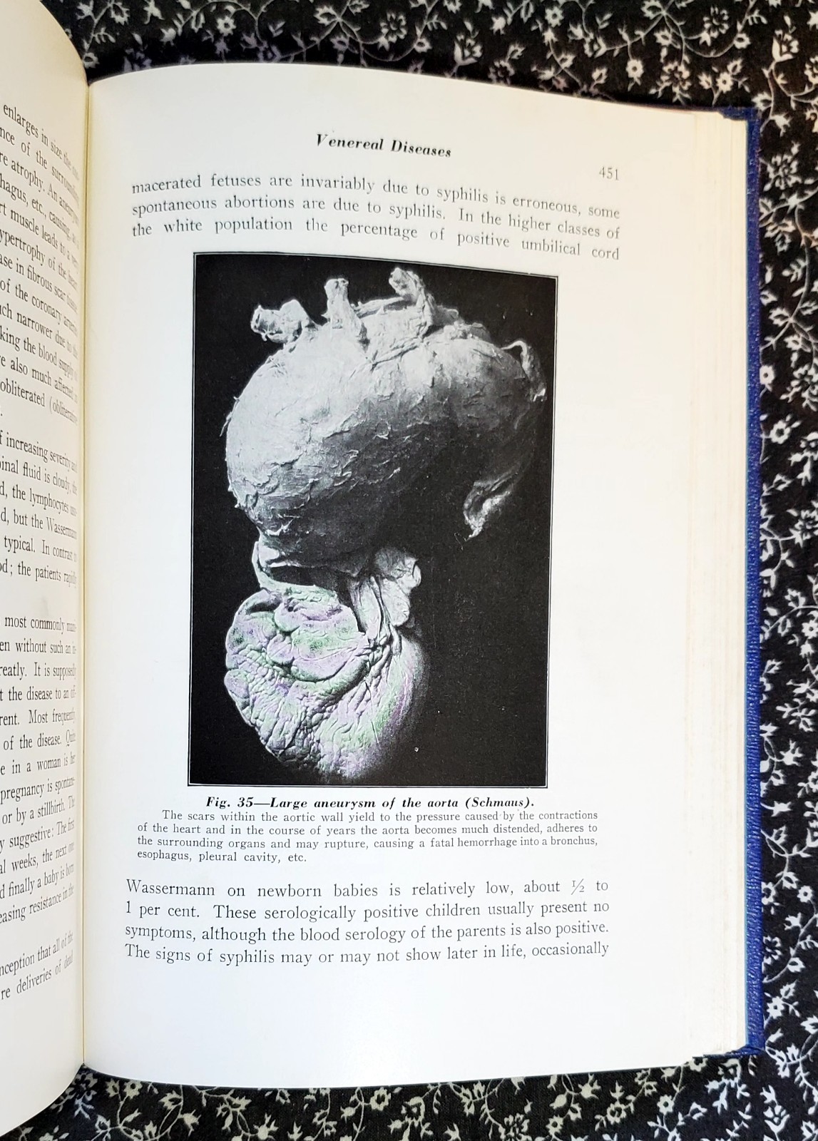 Microbiology Pathology And Nursing Eugene C. Piette, 1940, HC